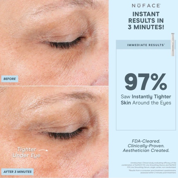 NWT! NuFACE FIX Line Smoothing Device - Picture 10 of 12